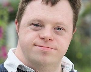 Синдром дауна причины возникновения и проявления