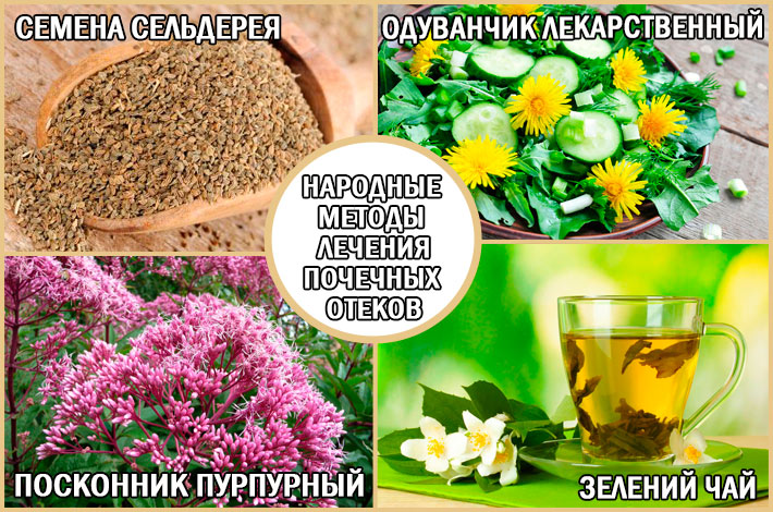 Народные методы лечения почечных отеков Почечные отеки: лечение отеков народными средствами