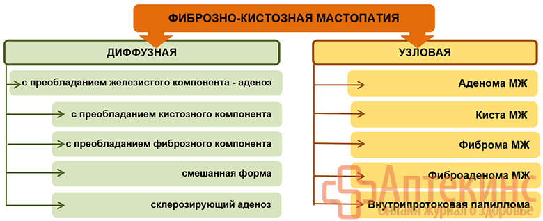 Классификация форм фиброзно-кистозной мастопатии Формы фиброзно-кистозной мастопатии