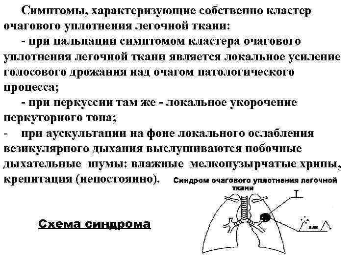 Симптомы, характеризующие собственно кластер очагового уплотнения легочной ткани: - при пальпации симптомом кластера очагового Симптомы, характеризующие собственно кластер очагового уплотнения легочной ткани: - при пальпации симптомом кластера очагового