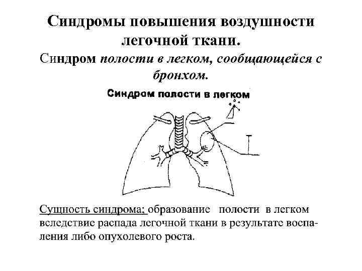 Синдромы повышения воздушности легочной ткани. Синдром полости в легком, сообщающейся с бронхом. Синдромы повышения воздушности легочной ткани. Синдром полости в легком, сообщающейся с бронхом.