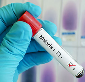 Патогенез малярии Патогенез малярии