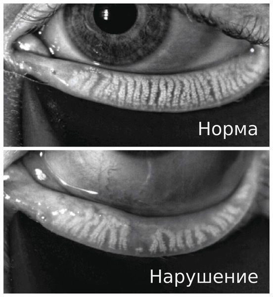 Результаты мейбографии Результаты мейбографии